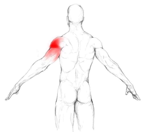 Unter der achselhöhle schmerzen Schreckt schmerzhaft