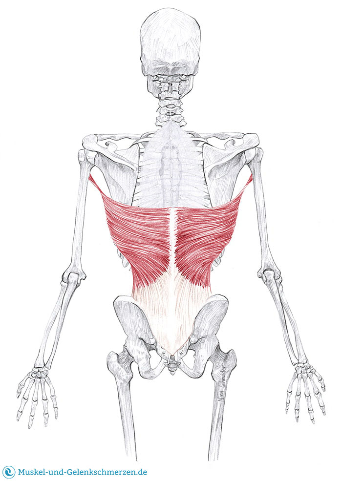 Latissimus dorsi Schmerzen und Triggerpunkte selbst behandeln