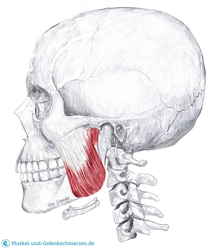 Masseter Muskel Verkleinern