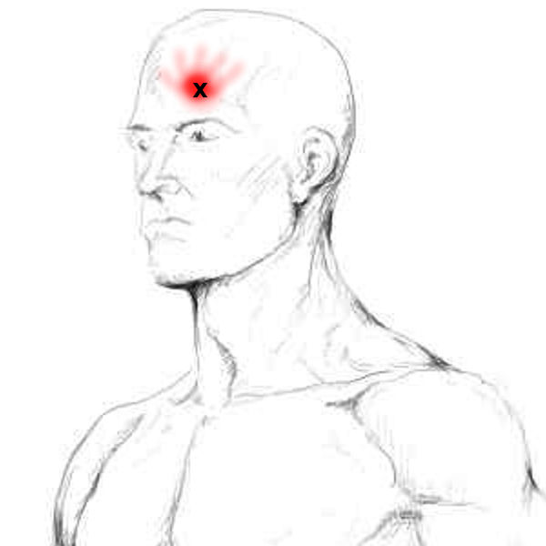 Frontalis & Occipitalis Schmerzen und Triggerpunkte selbst behandeln