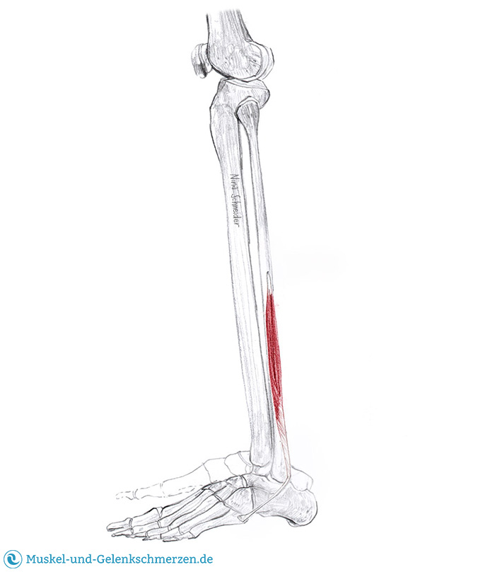 Peroneus longus, brevis und tertius Schmerzen und Triggerpunkte