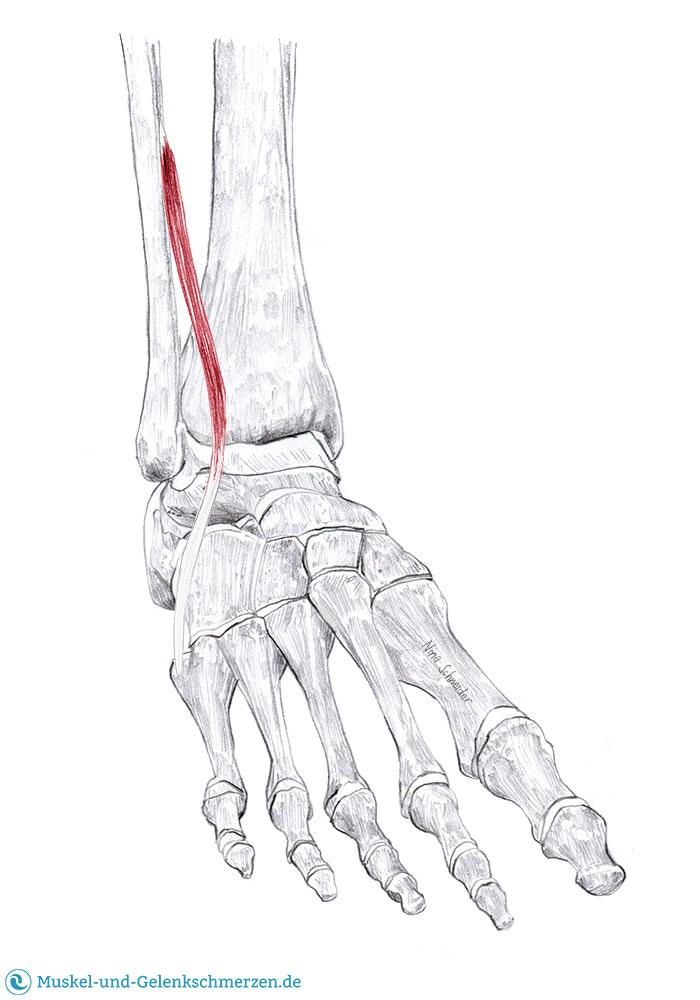 Peroneus longus, brevis und tertius Schmerzen und Triggerpunkte