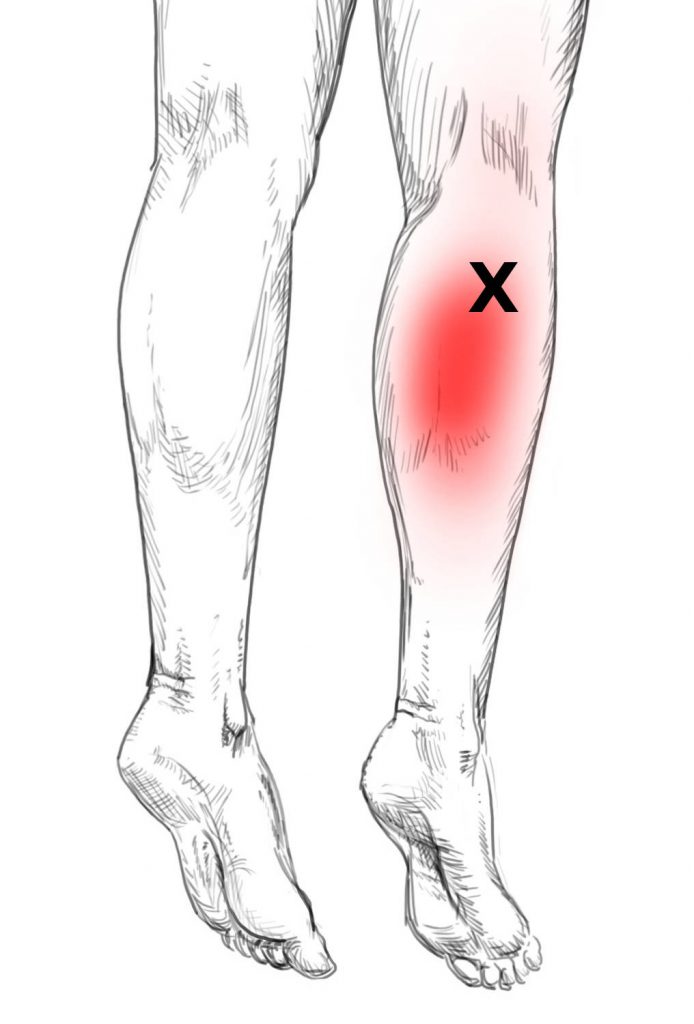 Soleus Schmerzen und Triggerpunkte selbst behandeln