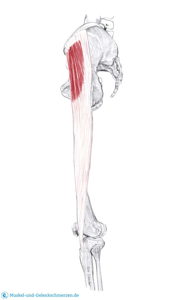 Tensor fasciae latae Schmerzen und Triggerpunkte selbst behandeln