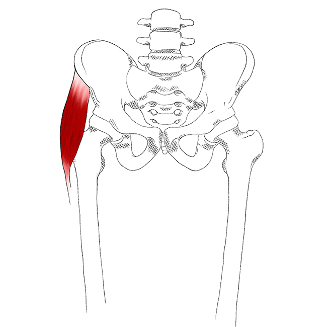 Tensor fasciae latae Schmerzen und Triggerpunkte selbst behandeln