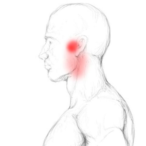 Pterygoideus Medialis Schmerzen Triggerpunkte