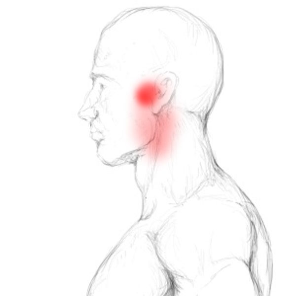 Pterygoideus medialis Schmerzen und Triggerpunkte selbst behandeln